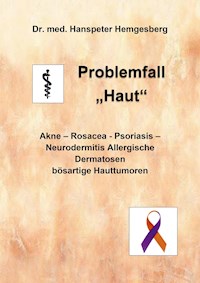 Problemfall "Haut" - Dr. med Hanspeter Hemgesberg - ebook