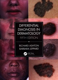Differential Diagnosis in Dermatology - Ashton Richard, Leppard Barbara - książka