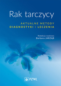 Rak tarczycy. Aktualne metody diagnostyki i leczenia - Barbara Jarząb - książka