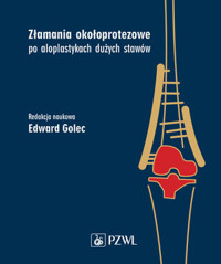 Złamania okołoprotezowe po aloplastykach dużych stawów - Edward Golec - książka