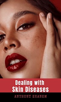 Dealing with Skin Diseases - Anthony Ekanem - ebook