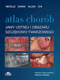 Atlas chorób jamy ustnej i obszaru szczękowo-twarzowego - Neville  B.W. , Damm D.D, Allen C.M. , Chi  A.C. - książka