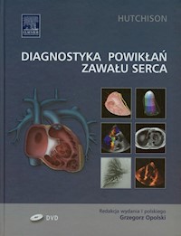 Diagnostyka powikłań zawału serca - Hutchison Stuart J. - książka