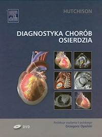 Diagnostyka chorób osierdzia - Hutchinson Stuart J. - książka