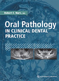 Oral Pathology in Clinical Dental Practice - Robert E. Marx - ebook