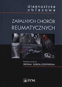 Diagnostyka obrazowa zapalnych chorób reumatycznych -  - książka