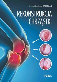 Rekonstrukcja chrząstki. Ratujemy kolano, nie wymieniamy - Bartłomiej Kacprzak - książka
