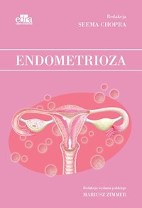 Endometrioza - Chopra S. - książka