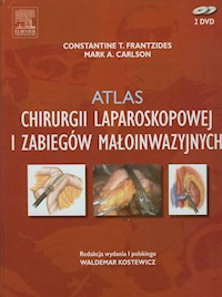 Atlas chirurgii laparoskopowej i zabiegów małoinwazyjnych - Frantzides Constantine T., Carlson Mark A. - książka
