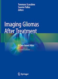 Imaging Gliomas After Treatment -  - ebook