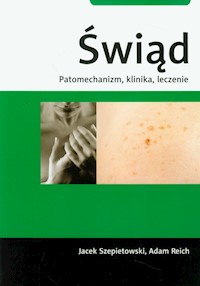 Świąd Patomechanizm, klinika, leczenie - Szepietowski Jacek, Reich Adam - książka