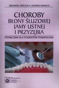 Choroby błony śluzowej jamy ustnej i przyzębia - Jańczuk Zbigniew, Banach Jadwiga - książka