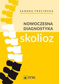 Nowoczesna diagnostyka skolioz - Trzcińska Sandra,Koszela Kamil,Myśliwiec Andrzej,Żurawski Arkadiusz - książka