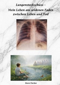 Lungensteckschuss - Mein Leben am seidenen Faden zwischen Leben und Tod - Horst Fischer - ebook