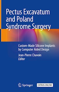 Pectus Excavatum and Poland Syndrome Surgery -  - ebook