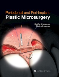 Periodontal and Peri-implant Plastic Microsurgery - Glécio Vaz de Campos - ebook