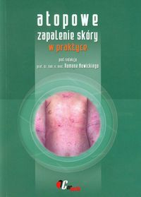 Atopowe zapalenie skóry w praktyce -  - książka