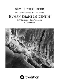SEM Picture Book of Untreated & Treated Human Enamel & Dentin - Ralf Janda - ebook