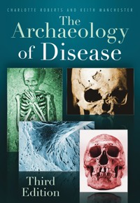 The Archaeology of Disease - Charlotte Roberts - ebook