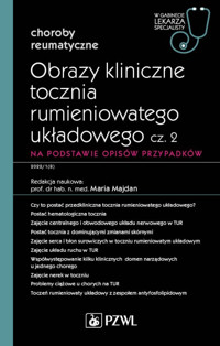 Obrazy kliniczne tocznia rumieniowatego układowego, cz. 2. Na podstawie opisów przypadków. W gabinec - Maria Majdan - książka