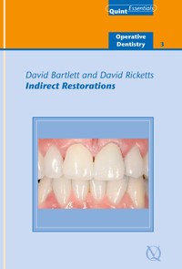 Indirect Restorations - David Bartlett - ebook