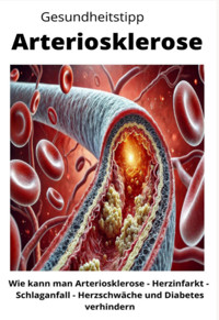 Gesundheitstipp Arteriosklerose - Maximilian Loidl - ebook