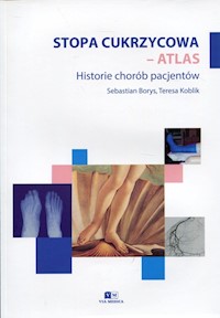 Stopa cukrzycowa - atlas - Borys Sebastian, Koblik Teresa - książka