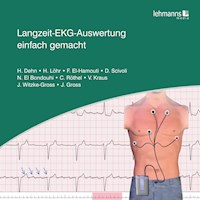 Langzeit-EKG-Auswertung einfach gemacht - Joseph Gross - ebook