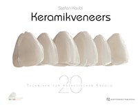 Keramikveneers - Stefen Koubi - ebook