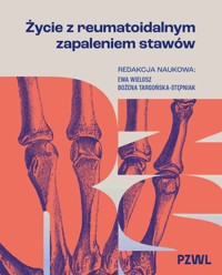 Życie z reumatoidalnym zapaleniem stawów - Bożena Targońska-Stępniak, Ewa Wielosz - książka