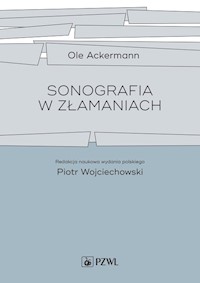 Sonografia w złamaniach - Ackermann Ole - książka