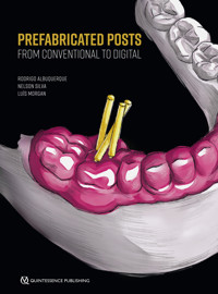 Prefabricated Posts - Rodrigo Albuquerque - ebook