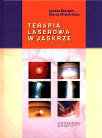 Terapia laserowa w jaskrze - Szelepin Łukasz, Misiuk-Hojło Marta - książka