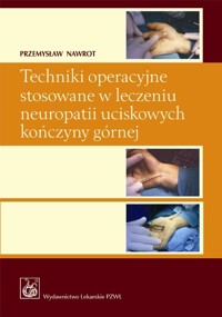 Techniki operacyjne stosowane w leczeniu neuropatii uciskowych kończyny górnej z płytą CD - Nawrot Przemysław - książka