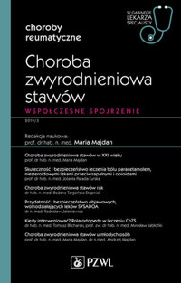 Choroba zwyrodnieniowa stawów. Współczesne spojrzenie - Maria Majdan - książka
