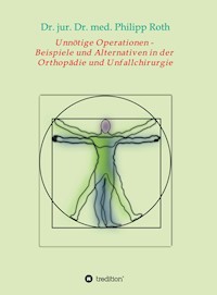 Unnötige Operationen -  Beispiele und Alternativen in der  Orthopädie und Unfallchirurgie - Dr. jur. Dr. med. Philipp Roth - ebook