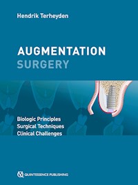 Augmentation Surgery - Hendrik Terheyden - ebook