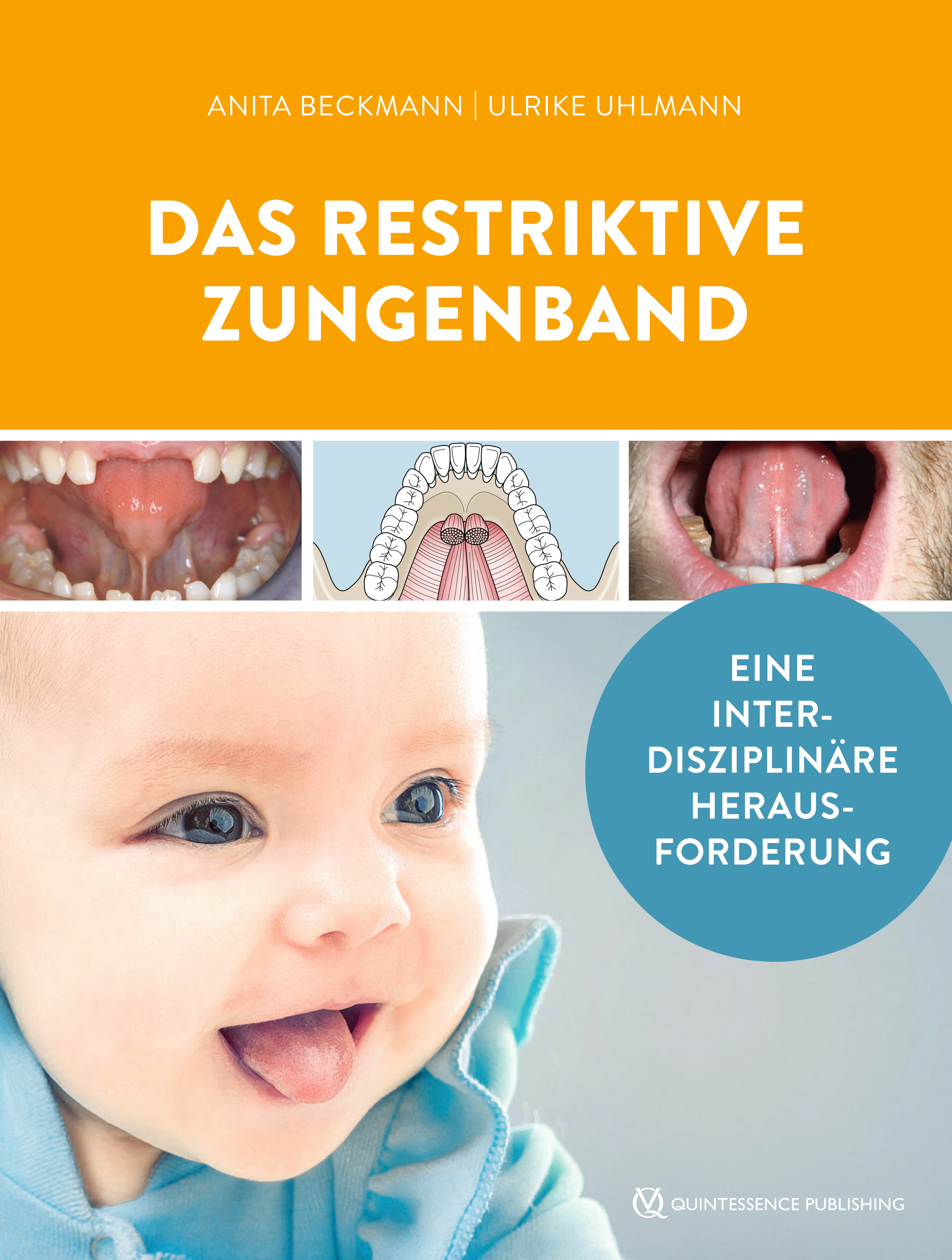 Das restriktive Zungenband