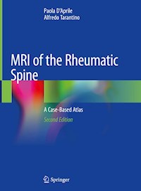 MRI of the Rheumatic Spine - Paola D'Aprile - ebook