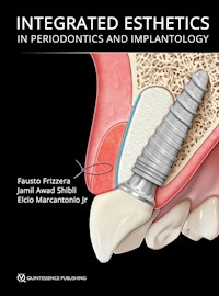 Integrated Esthetics in Periodontics and Implantology - Fausto Frizzera - ebook