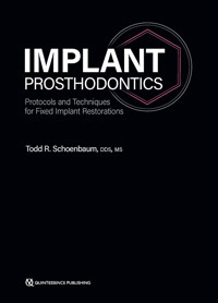 Implant Prosthodontics - Todd R. Schoenbaum - ebook