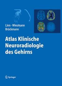 Atlas Klinische Neuroradiologie des Gehirns -  - ebook