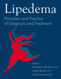 Lipedema -  - ebook