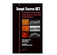 Swept Source OCT - Romanowska-Dixon Bożena, Jakubowska Barbara, Karska-Basta Izabella - książka