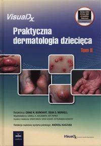 Praktyczna dermatologia dziecięca Tom 2 -  - książka