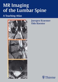 MR Imaging of the Lumbar Spine - Kraemer Juergen - ebook