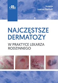 Najczęstsze dermatozy w praktyce lekarza rodzinnego -  - książka