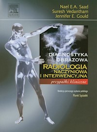 Radiologia naczyniowa i interwencyjna - Saad Nael E.A., Vedantham Suresh, Gould Jennifer E. - książka