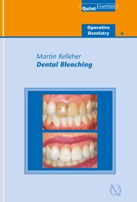 Dental Bleaching - Martin Kelleher - ebook