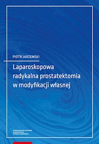 Laparoskopowa radykalna prostatektomia w modyfikacji własnej - Jarzemski Piotr - książka
